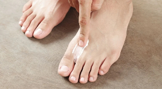 Нанасяне на крем от гъбички между пръстите на краката