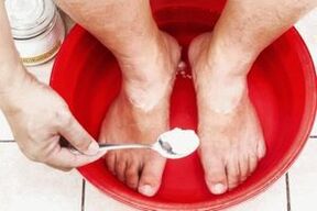 Вана със сода и катранен сапун ще премахне гъбичките по краката